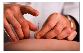 images/Acupuncture 1.jpg